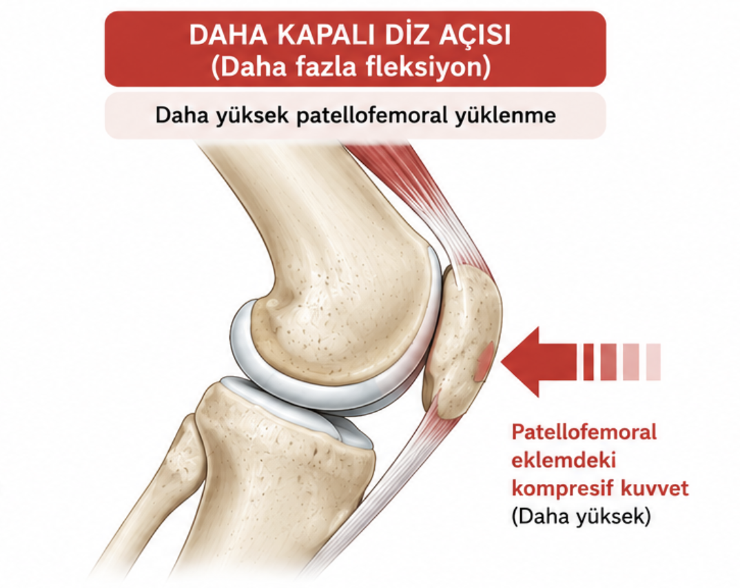 Kapalı diz açısında patellofemoral eklem yüklenmesi görseli